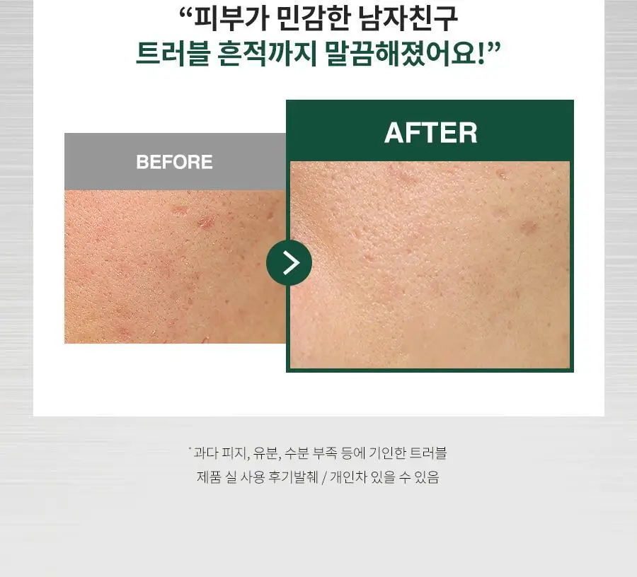 [리뉴얼/트러블/면도후] 닥터지 레드 블레미쉬 포 맨 진정 올인원 150ml 2종 (단품/증정 기획) 상세페이지 6
